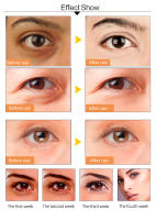 Máscaras de Ojos de Colágeno Dorado 100pcs Anti-Envejecimiento, Adiós a las Ojeras, Hidratante - details 8
