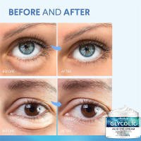 Crema para los Ojos Anti-Arrugas Instantánea Firmeza para Líneas Finas Elimina Ojeras y Bolsas - details 6