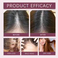 HOEGOA mejora el cabello seco y encrespado, nutre el cabello suave, aceite capilar para el cuidado del cuero cabelludo. - details 9