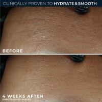 RoC Retinol Correxion Max hidratación diaria crema hidratante facial antienvejecimiento con ácido hialurónico, crema para el cuidado de la piel sin aceite para pieles finas - details 3