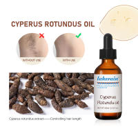 Depilación Cyperus Rotundus aceite axilas piernas pelo cuidado del cuerpo aceite hidratante piel inhibe el cabello aceite esencial de planta de Cyperus - details 1