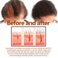Loción de raíz de hierbas que fija la línea densa, repara, endurece, hidrata y previene la caída del cabello - details 7