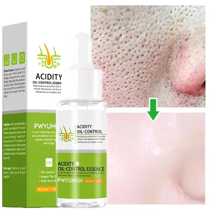 Crema Reductora de Poros de Ácido Salicílico Adiós a los Pulgares, Reparación de Piel, Estiramiento - 1