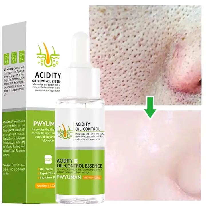 Crema Reductora de Poros de Ácido Salicílico Adiós a los Pulgares, Reparación de Piel, Estiramiento - 1