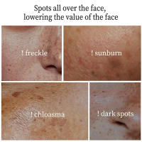 Whitening Freckle Cream Face Brightening Cream Niacinamide Reduce Chloasma Melasma Melanin Fade Fine Lines Lighten Dark Skincare - details 2
