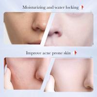 Crema para eliminar manchas blanqueadoras de Ácido Kójico, elimina el melasma, corrección de melanina, mejora la piel, aclara las manchas oscuras, cosméticos - details 1