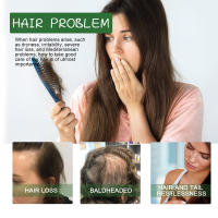 Batana esencial para reparar, fortalecer, reafirmar, prevenir la caída y nutrir el aceite para el cabello del cuero cabelludo - details 7