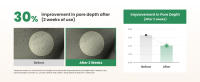 AXIS-Y LHA Peel Fill Balancing Removedor de espinillas y minimizador de poros - Crema hidratante facial vegana coreana para todo tipo de piel - details 6