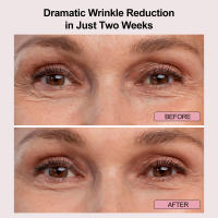 Máscara Facial de terapia de luz Led, equipo de belleza para uso doméstico, equipo de masaje ocular, máscara Ems con cable, máscara de ojos Ems para estiramiento Facial - details 8