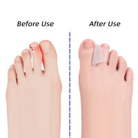 Protector de Pie con Silicona Hammer Overlapping para Alivio del Dolor de Buniones Corrector Separador Ortodóntico Manicura - details 2