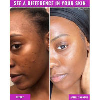 Good Molecules before/after results