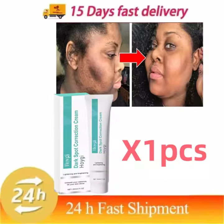 Crema Blanqueadora Potente Elimina Manchas de Melanina Rápido Hidrata y Ilumina la Piel - 1