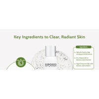 Limpiador facial para el acné Exposed Care, cara suave con tendencia al acné con ácido salicílico, limpiador clarificador de poros para adolescentes y adultos, todos - details 2