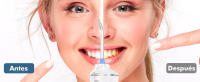 Irrigador Dental portátil Profesional, 350ML, Bucal Inalámbrico, 6 Boquillas, 5 Modos, Para Limpieza de Dientes - details 3