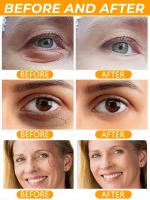 Crema para los Ojos de Acción Rápida Anti-Arrugas, Reafirmante, Adiós a las Hinchazones, Cuidado de los Ojos para Líneas Finas Herramientas de Cuidado de la Piel Facial - details 1