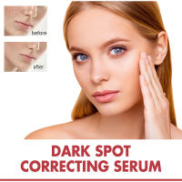 Sérum Facial Coreano Niacinamida Ilumina la Piel, Rejuvenece, Hidrata, Blanquea, Desvanece Manchas y Líneas Finas Herramienta de Cuidado de la Piel de Belleza - details 2