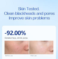 Gongpei Provitamina B5 Mascarilla limpiadora con ácido salicílico Limpieza profunda para eliminar puntos negros y reducir los poros - details 7