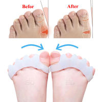 Separador de dedos del pie, Corrector de Hallux Valgus, 2 piezas, martillo ortopédico, Alisador, esparcidor, almohadillas para el cuidado de los pies - details 16