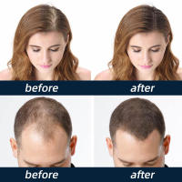 Spray para hombres, línea de cabello reafirmante, cuidado anticaída, líquido espeso - details 7