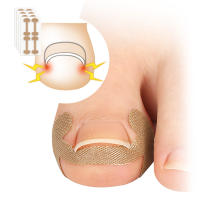 Pegatinas de Corrección de Uñas Herramienta de Cuidado de Piedras 4Pcs/8Pcs/12Pcs - details 3
