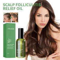 Cuidado de la oliva que alivia el enrojecimiento del cuero cabelludo, repara los folículos de acné, la picazón y la esencia para cabello apretado. - details 1