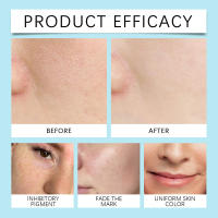 Nicotinamida, glicerina, control de temperatura del agua y aceite, hidratante, nutritivo, piel suave, aplicación húmeda, tóner de esencia - details 11