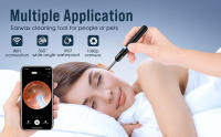 Limpiador de oídos con cámara 1080P, otoscopio con luz, Kit con 6 púas para iPhone, iPad, teléfonos Android - details 0