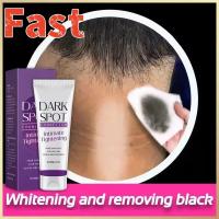 Crema Blanqueadora Effectiva para Piel Oscura Nicotinamida Melanina Cuidado de la Piel Corporal - details 0
