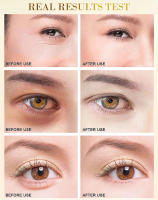 Máscara de Ojos de Algas Dorada Hidratante, Refirme, Reduce Ojeras Cuidado de Ojos de Belleza Expert - details 9