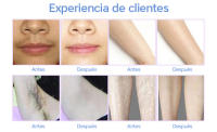 Depiladora IPL de enfriamiento, máquina de depilación láser permanente para el hogar, recortadora de Bikini, lámpara reemplazable, fotorejuvenecimiento eléctrico - details 10