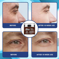 Hidratante Facial para Hombres VAITE con Colágeno Anti-envejecimiento Retinol - details 3