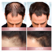 Spray de arroz para el cuero cabelludo fuerte, suave, nutritivo, brillante, hidratante, cuidado del cabello - details 8
