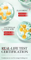 Crema para los Ojos de Nicotinamida SADOER Elimina Ojeras y Hinchazón, Hidrata y Belleza Coreana Cuidado de la Piel de Belleza - details 4