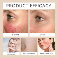 Y humecta la protección aislante exterior en verano Crema protectora ligera natural no pegajosa - details 1