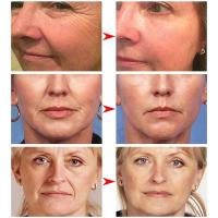 Eliminador instantáneo de arrugas que se desvanecen líneas finas crema facial antienvejecimiento reafirmante Lifting blanqueamiento brillo e hidratación apretar el cuidado de la piel - details 4