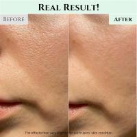 Limpiador refrescante Joseon Green Plum Beauty combinado con la crema hidratante facial Dynasty, adecuado para pieles secas - details 4