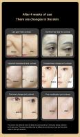 Herramienta profesional multifuncional para eliminar arrugas, instrumento de belleza para el cuidado Facial, masaje Facial - details 9