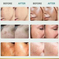 Potente crema blanqueadora que elimina manchas, ilumina la piel, elimina rápidamente la pigmentación de melanina, melasma, manchas oscuras, cuidado de la piel coreano - details 6
