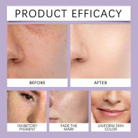 Loción diaria rejuvenecedora facial con retinol, cuidado de la piel suave transparente y esencia hidratante - details 9