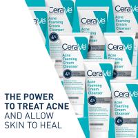 CeraVe Acne Foaming Cream Cleanser, limpiador facial con peróxido de benzoilo al 4% con ácido hialurónico, niacinamida y ceramidas, tratamiento diario suave para el acné para la cara - details 1