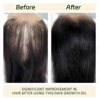 Batana Oil Repair Aceite Esencial para el Cuidado del Cabello Dañado 30ml - details 6