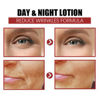 Bolsa para ojos instantánea, crema para eliminar ojos, líneas finas, partículas antigrasa, ojeras, hinchazón, levanta, ilumina el cuidado de los ojos coreano, nuevo - details 3