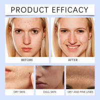 El aceite esencial vegetal con esencia iluminadora de retinol hidrata, ilumina e hidrata la piel. - details 8
