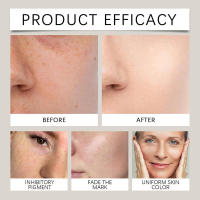 La vitamina C de caracol aplica una mascarilla facial para hidratar, reafirmar, humectar y limpiar suavemente los poros. - details 3