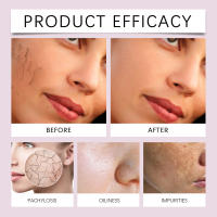 Mascarilla facial reafirmante hidratante profunda exfoliante suave de colágeno - details 11