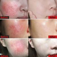 Crema de día correctora antienrojecimiento Facial, crema para el cuidado de la piel sensible a la picazón, crema hidratante para iluminar la Base, cosméticos - details 3