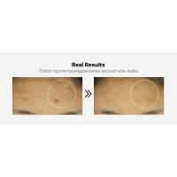 Suero tónico de colágeno péptido 6X, niacinamida y ácido hialurónico, esencia facial revitalizante y revitalizante para todo tipo, coreano - details 1