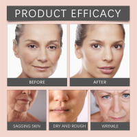 Crema de Retinol 30g Anti-envejecimiento, Desvanecimiento de Arrugas, Adiós a las Ojeras - details 15