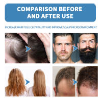 Aceite hidratante rodante para el cuidado del cabello y la barba, masaje suave y nutritivo para el cuero cabelludo - details 8