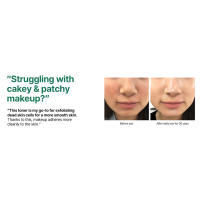 SOME BY MI AHA BHA PHA 30 Days Miracle 5.07oz, 150ml Tónico facial exfoliante con ácido salicílico para todo tipo de poros y aceite diarios - details 3